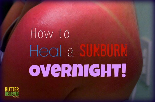 How To Heal A Sunburn Overnight With Two Simple Ingredients Butter Believer 